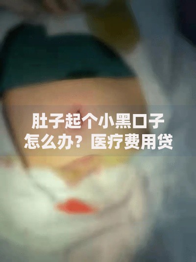 肚子起个小黑口子怎么办？医疗费用贷款解决方案解析