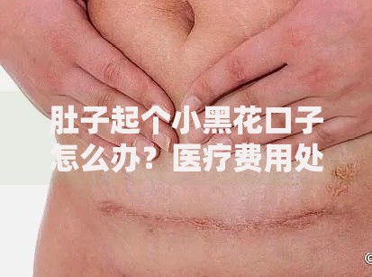 肚子起个小黑花口子怎么办？医疗费用处理与贷款方案解析