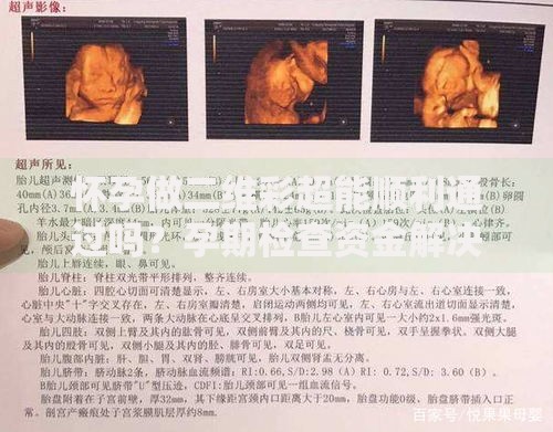 怀孕做二维彩超能顺利通过吗？孕期检查资金解决方案解析