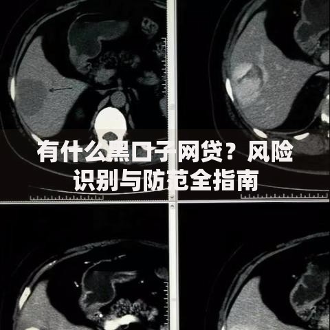 有什么黑口子网贷？风险识别与防范全指南