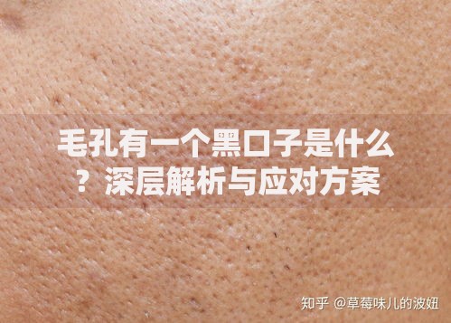 毛孔有一个黑口子是什么？深层解析与应对方案